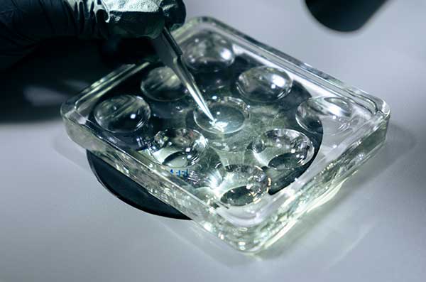 petri dish with specimens