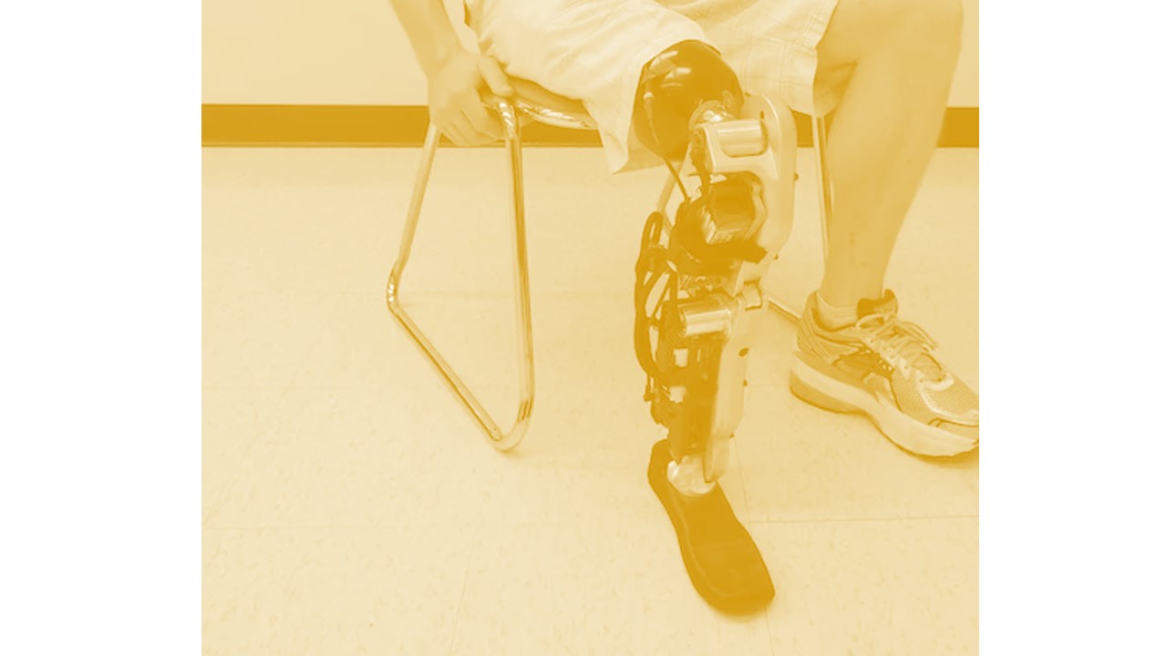 person sitting in chair wearing prosthetic leg